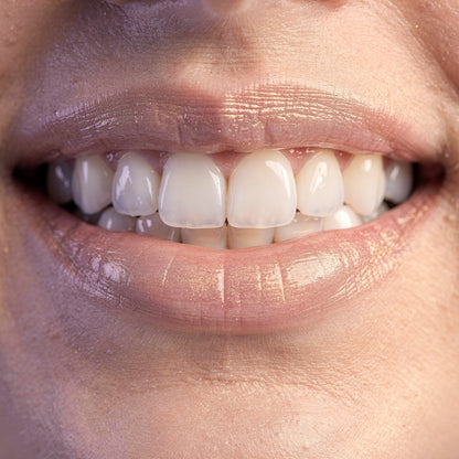 Primer plano de una sonrisa blanca y radiante