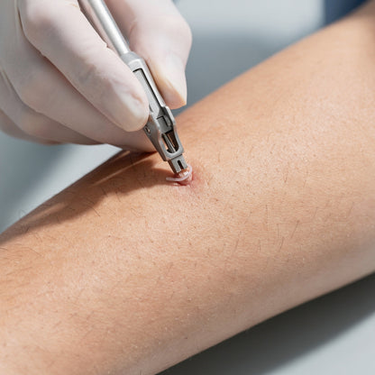 Aplicación del sistema de ligadura médica ÁUREA DermiFix